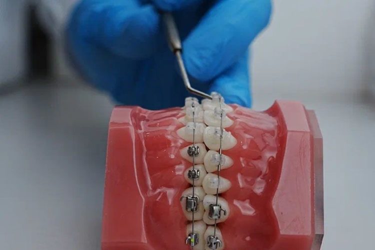 Что делает ортодонт в стоматологии